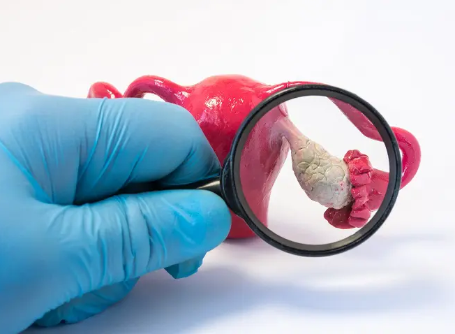 GYNAECOLOGICAL DISORDERS